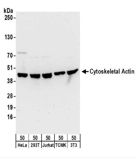 IHC-plus™ ACTB / Beta Actin Antibody (N-Terminus)