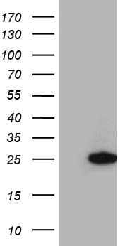 RGS10 Antibody (clone OTI8H4)