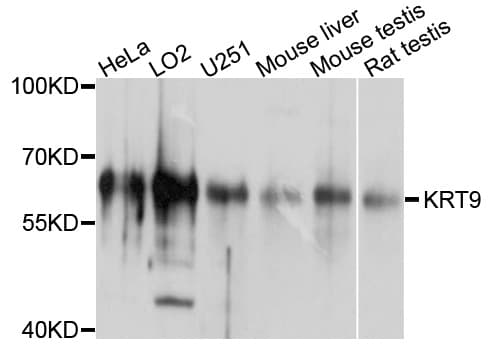 KRT9 / CK9 / Cytokeratin 9 Antibody