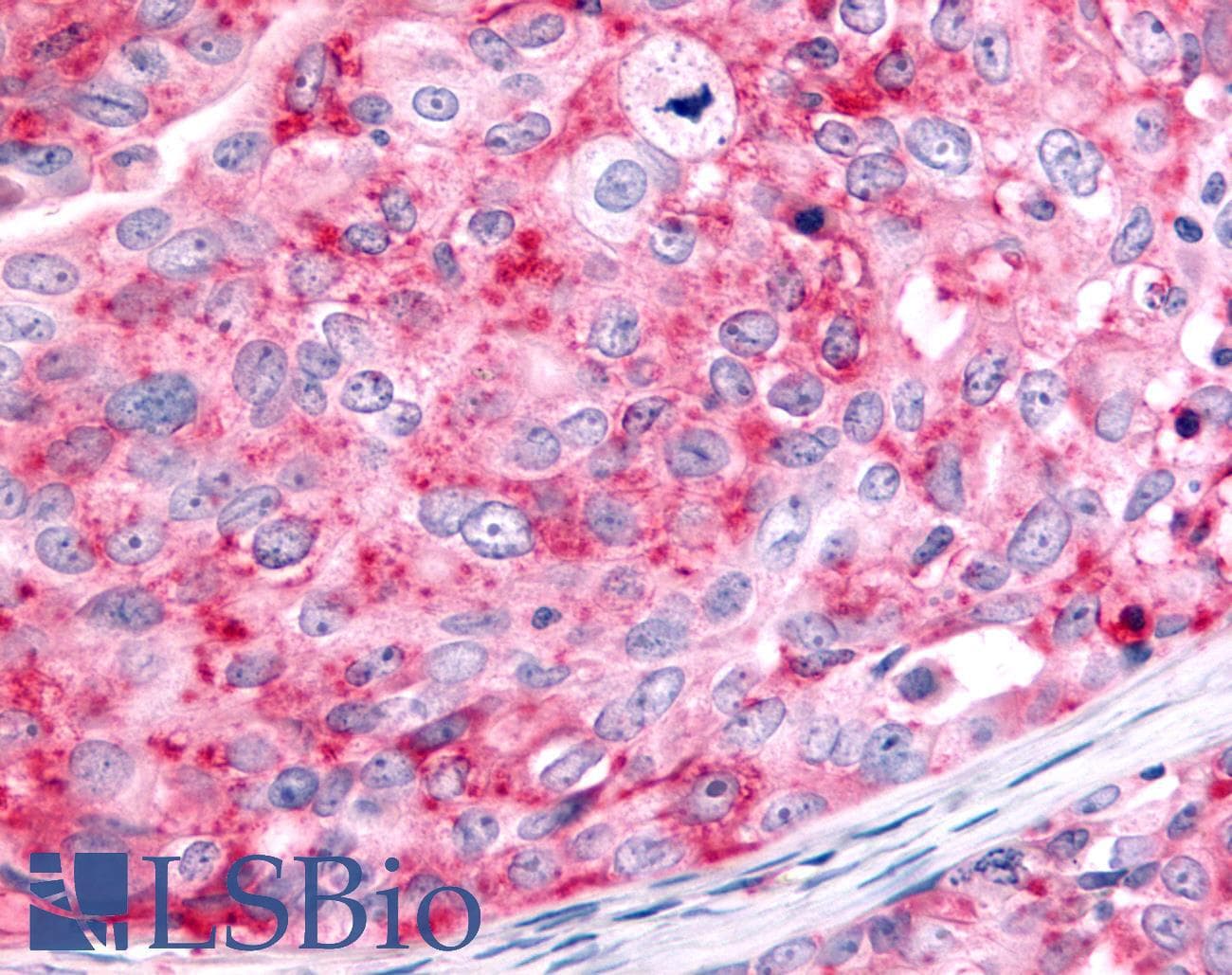 PathPlus™ Polyclonal Rabbit anti-Human HUNK / B19 Antibody (Kinase Domain, IHC)
