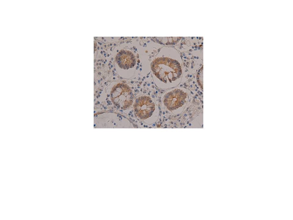 Monoclonal Mouse anti-Human KRT8 / CK8 / Cytokeratin 8 Antibody (IHC, WB)