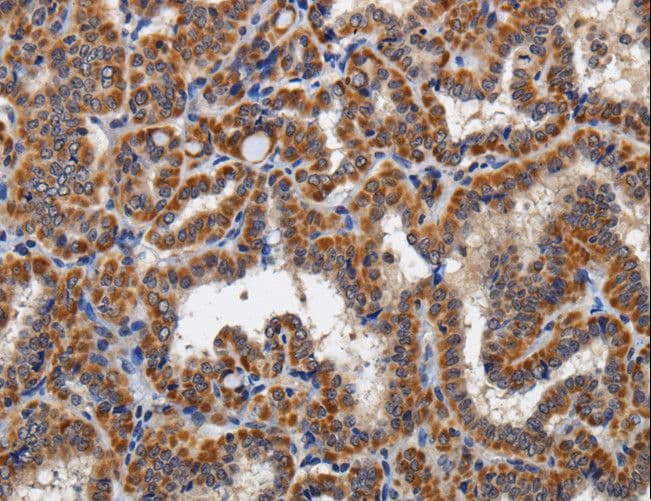 KLK6 / Kallikrein 6 Antibody