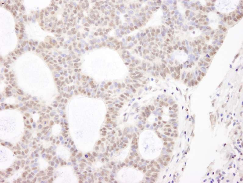 Polyclonal Rabbit anti-Human CHD3 Antibody (aa1950-2000, IHC)