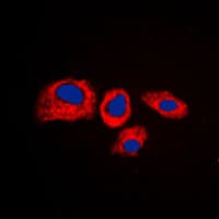 RPS4Y1 Antibody (C-Terminus)