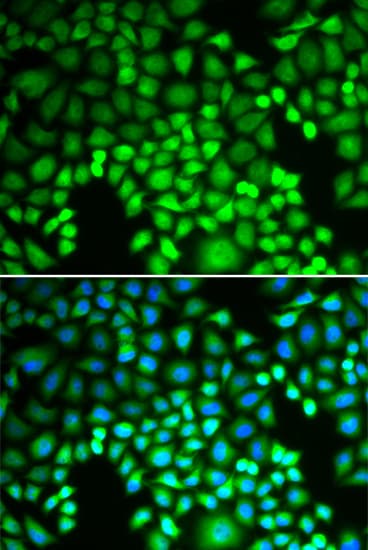 Polyclonal Rabbit anti-Human PSMA4 Antibody (IHC, IF, WB)