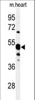 Polyclonal Rabbit anti-Human NT5C1A / CN1A Antibody (aa91-119, IHC, WB)