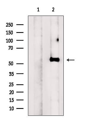 Polyclonal Rabbit anti-Human NMD3 Antibody (WB)