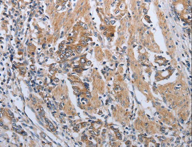 PDCD1 / CD279 / PD-1 Antibody