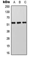STK11 / LKB1 Antibody (phospho-Thr189)