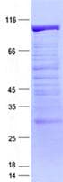 Human MTA1 Protein (Recombinant GST, N-terminus + His, C-terminus)