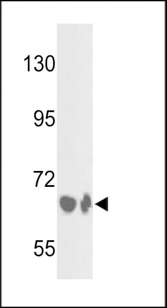 CFB / Complement Factor B Antibody (aa395-422)