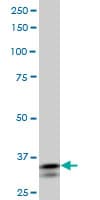 SHOX2 Antibody (aa117-204, clone 1D1)