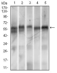 Monoclonal Mouse anti-Human RING1 Antibody (clone 8C12F4, aa79-263, IHC, WB)