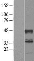 ABHD2 Protein (Over-Expression Lysate Myc-DDK (Flag))