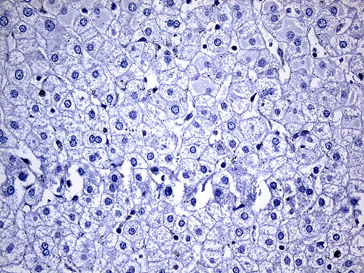 NAT1 / AAC1 Antibody (clone OTI6D7)