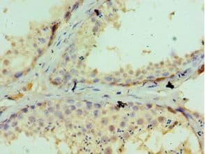 Polyclonal Rabbit anti-Human GLRX3 / Glutaredoxin 3 Antibody (aa1-335, IHC, WB)