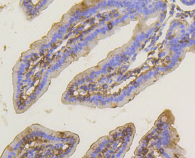 PRKCA / PKC-Alpha Antibody