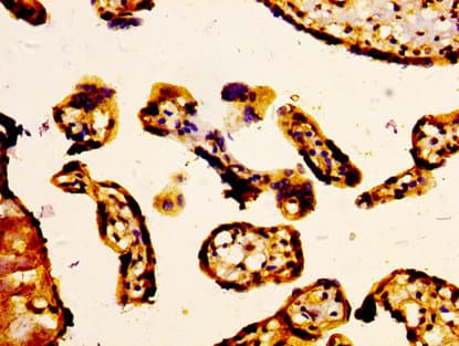 Polyclonal Rabbit anti-Human ABCC5 / MRP5 Antibody (IHC)