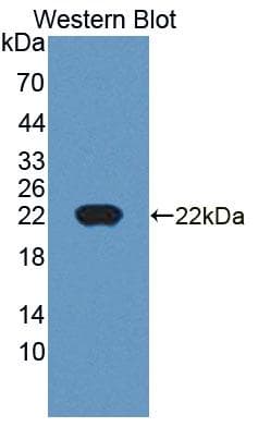 CDKN2D / p19 INK4d Antibody (Biotin)