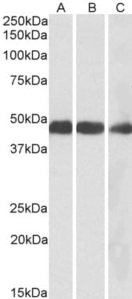 IHC-plus™ IDH2 Antibody (aa418-429)