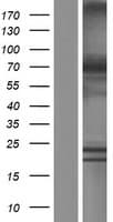Human XPNPEP1 / Aminopeptidase P Protein (Over-Expression Lysate Myc-DDK (Flag))