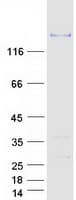 Human DMD / Dystrophin Protein (Recombinant Myc-DDK (Flag))