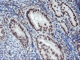 ENPEP / Aminopeptidase A Antibody (clone OTI4G8)