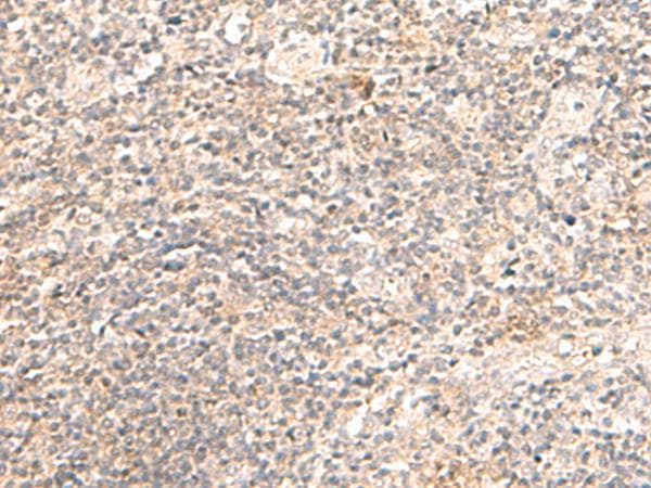 Polyclonal Rabbit anti-Human TRAPPC1 / MUM2 Antibody (IHC)
