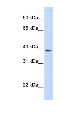FAM76B Antibody (aa108-157)