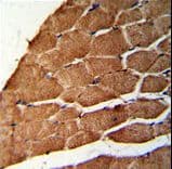 Polyclonal Rabbit anti-Human CCHCR1 Antibody (aa599-627, IHC, IF, WB)