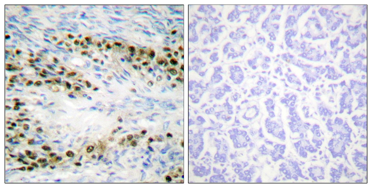 AKT1 Antibody (p72)