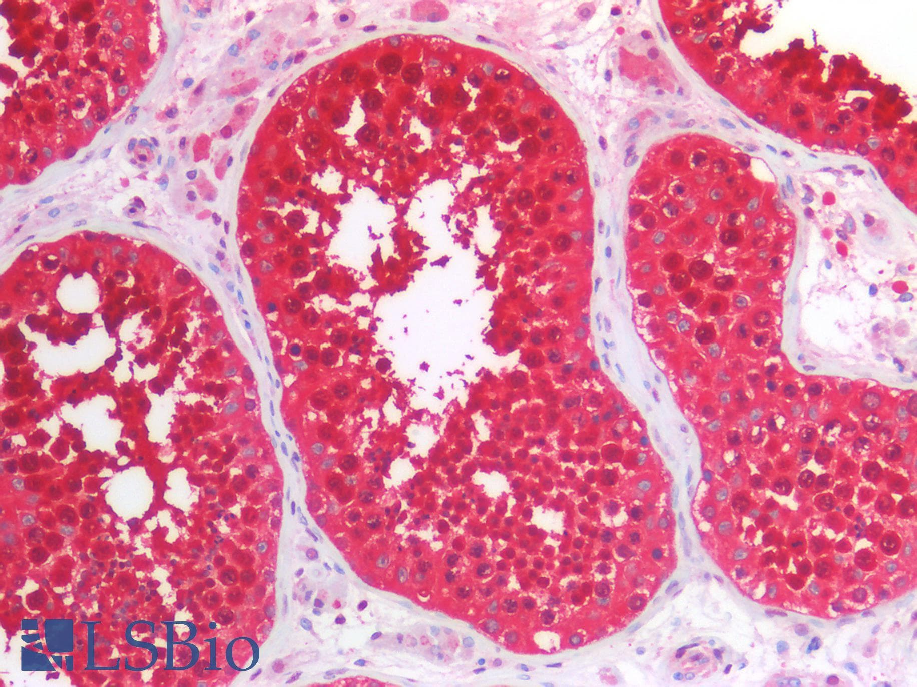 IHC-plus™ Monoclonal Mouse anti-Human HSP70 / Heat Shock Protein 70 Antibody (clone 5C3, IHC, IF, WB)
