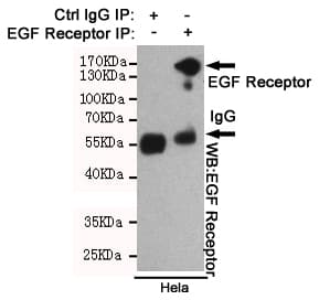 Monoclonal Mouse anti-Human EGFR Antibody (WB)