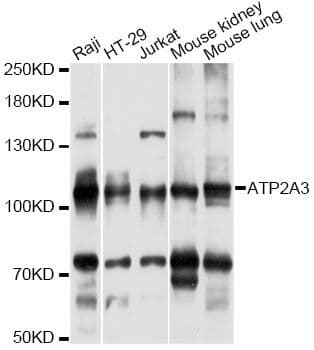 Polyclonal Rabbit anti-Human ATP2A3 / SERCA3 Antibody (WB)