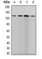 PLOD / PLOD1 Antibody