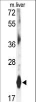 Polyclonal Rabbit anti-Mouse DHFR Antibody (aa135-164, IHC, WB)