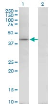 Monoclonal Mouse anti-Human TARBP2 / TRBP2 Antibody (clone 1G6, WB)