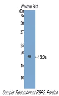 RBP2 / CRBPII Antibody (aa1-134)