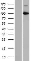 CARNS1 Protein (Over-Expression Lysate Myc-DDK (Flag))