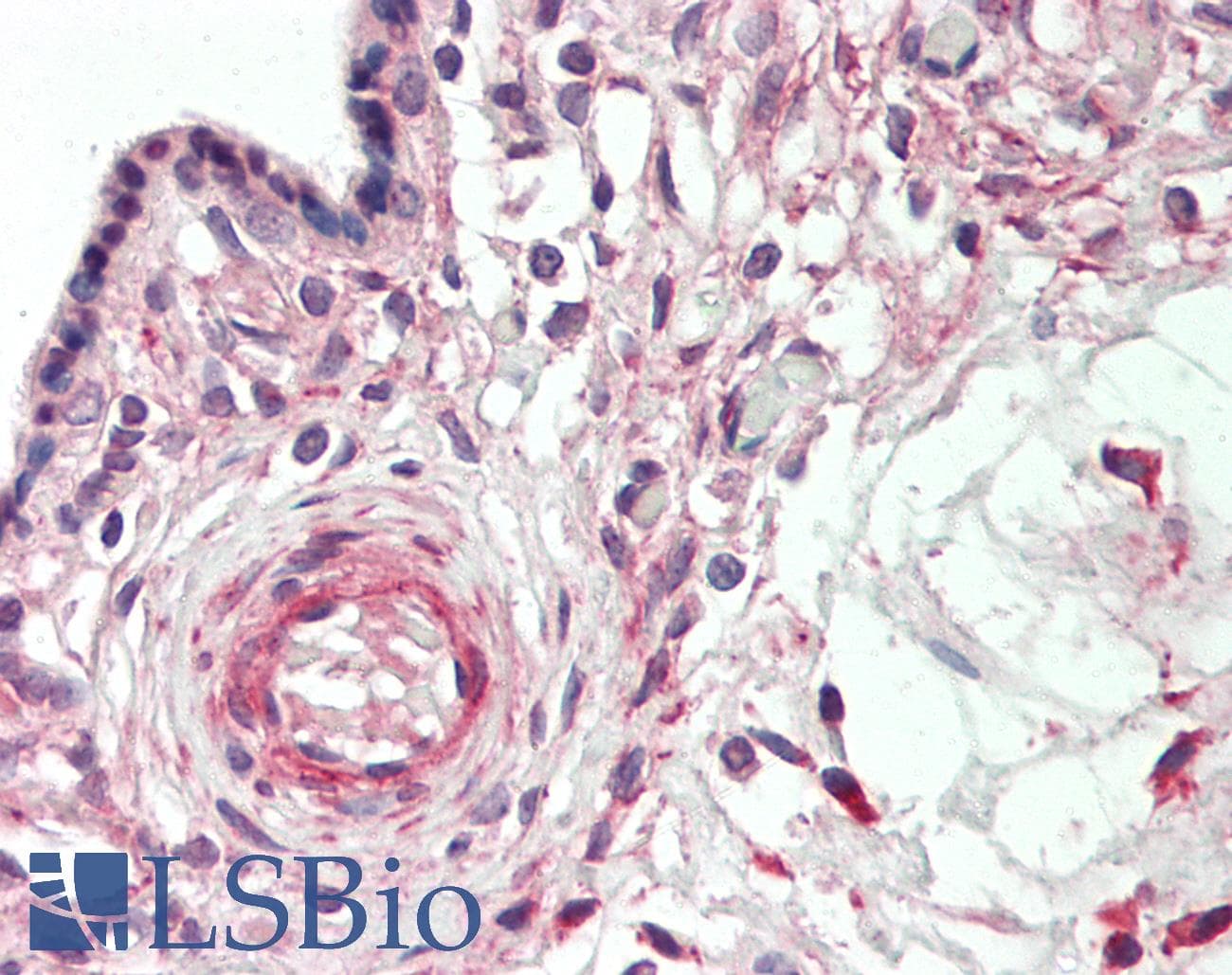 IHC-plus™ Polyclonal Rabbit anti-Human BACH1 Antibody (aa134-421, IHC, WB)