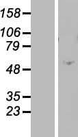 ZNF770 Protein (Over-Expression Lysate Myc-DDK (Flag))