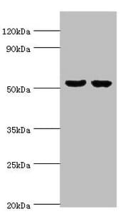 Polyclonal Rabbit anti-Human GBA3 / CBG Antibody (aa1-162, IHC, WB)