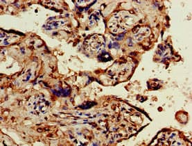 OBSL1 Antibody