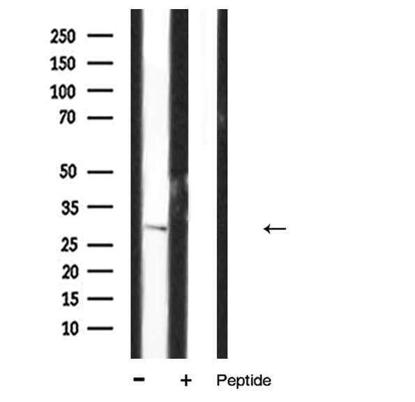 Polyclonal Rabbit anti-Human IL-1B / IL-1 Beta Antibody (IHC, IF, WB)