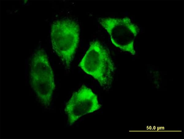 Monoclonal Mouse anti-Human PARK2 / Parkin 2 Antibody (clone 1H4, IF, WB)