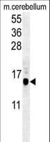 Polyclonal Rabbit anti-Human MAP1LC3B / LC3B Antibody (aa74-106, IHC, WB)