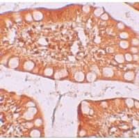 TFF3 / Trefoil Factor 3 Antibody