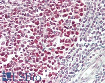 IHC-plus™ RBBP7 / RbAp46 Antibody (aa1-50)