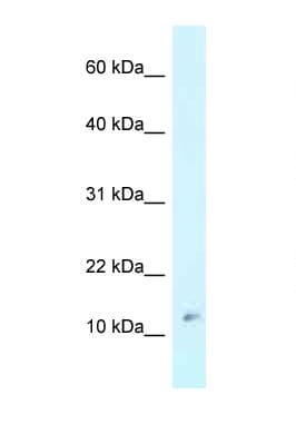 Polyclonal Rabbit anti-Human RPL37 / Ribosomal Protein L37 Antibody (aa40-89, WB)