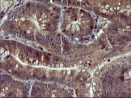 TP73 / p73 Antibody (aa167-409, clone OTI1B5)